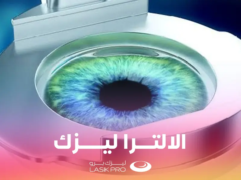 عملية الالترا ليزك