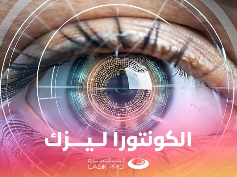 كونترا ليزك
