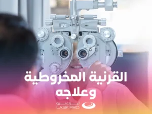 القرنية المخروطية وعلاجها