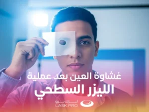 غشاوة العين بعد عملية الليزر السطحي