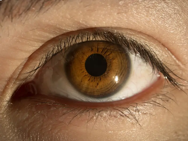  تحرك قرنية العين من مكانها